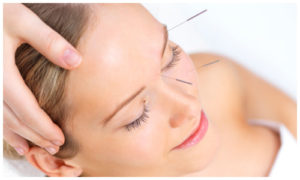 Cosmetic-Acupuncture2.jpg